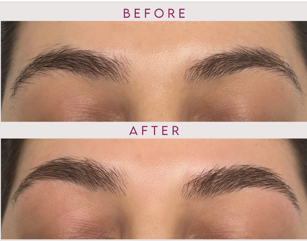 Before and after brow Lamination Transformation