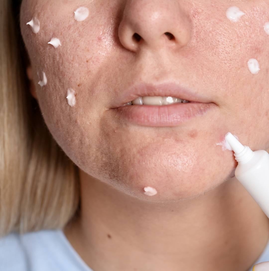 f (3) - mashmeover esthetics