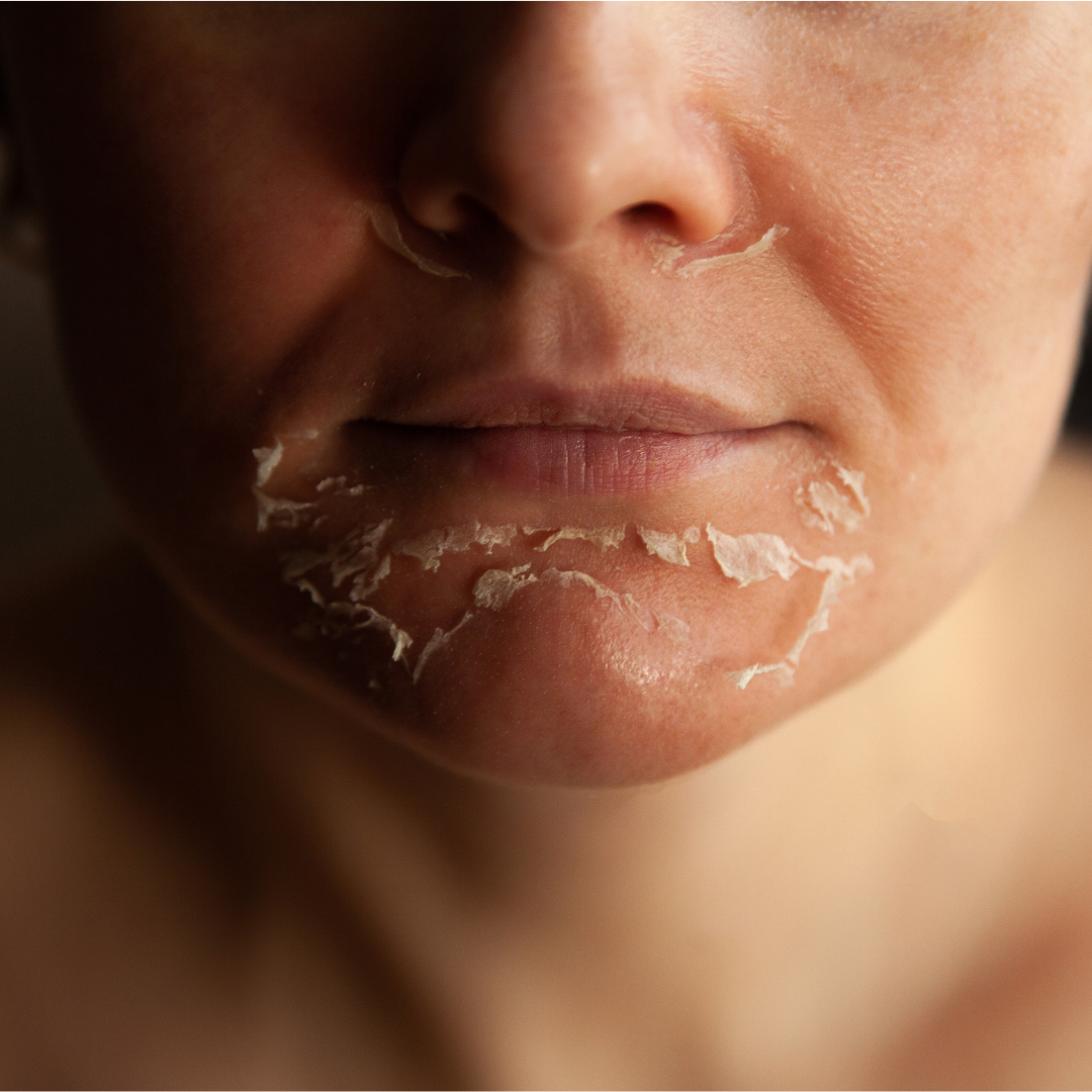 f (4) - mashmeover esthetics