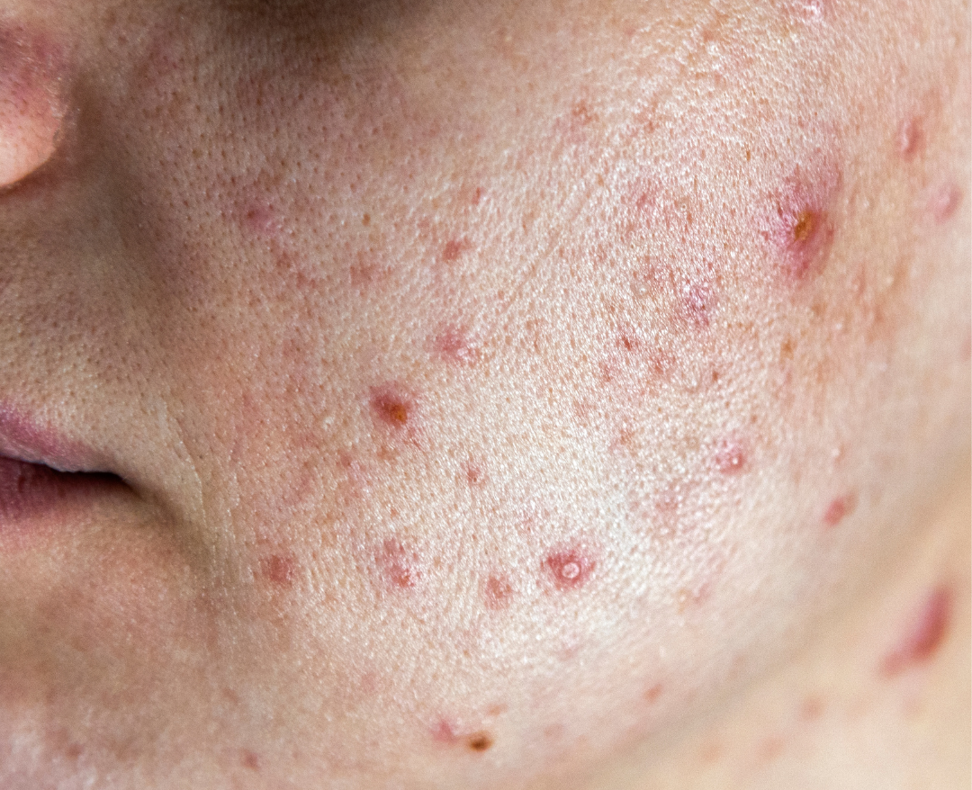 f - mashmeover esthetics