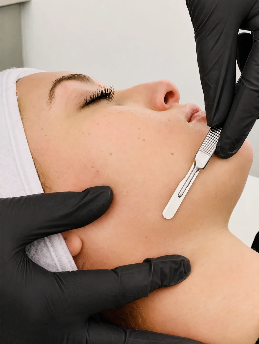 Dermaplane facial treatment at MASHMEOVER Esthetics in Orange, CA