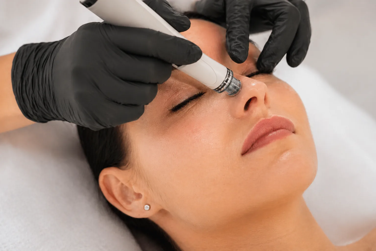 HydroFacial treatment at MASHMEOVER Esthetics in Orange, CA